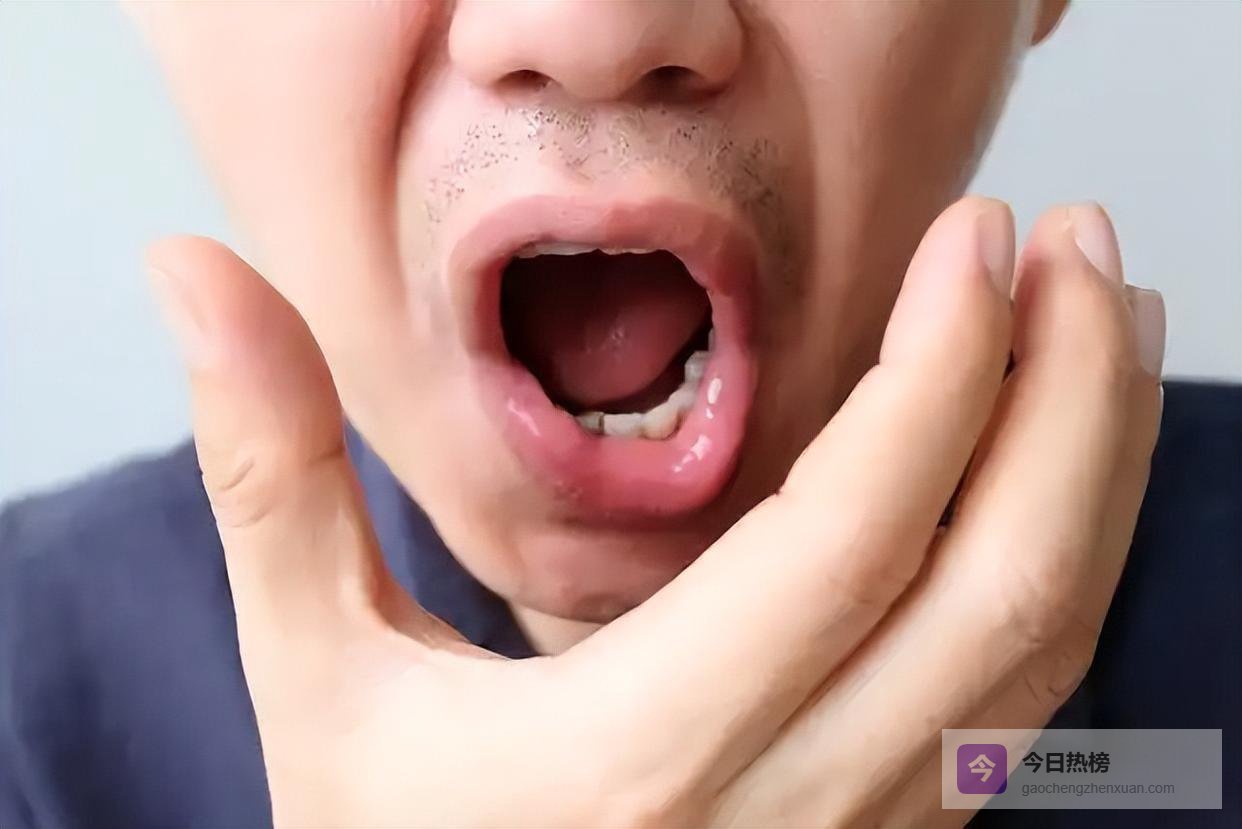 阴虚是癌变的温床，阴虚常有的5种信号，看看你有没有中招