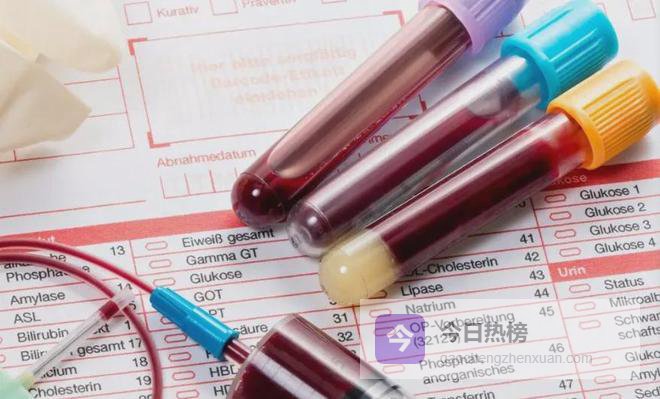 血小板“狂飙”到1050？别慌！看中医如何“疏通”淤堵的血管