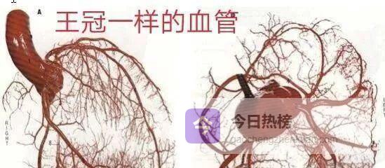 冠状动脉：从“王冠”到生命线的全程解码